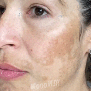 Aclara, despigmenta y regenera tu piel con ✨Luminia – Amélie Colombia