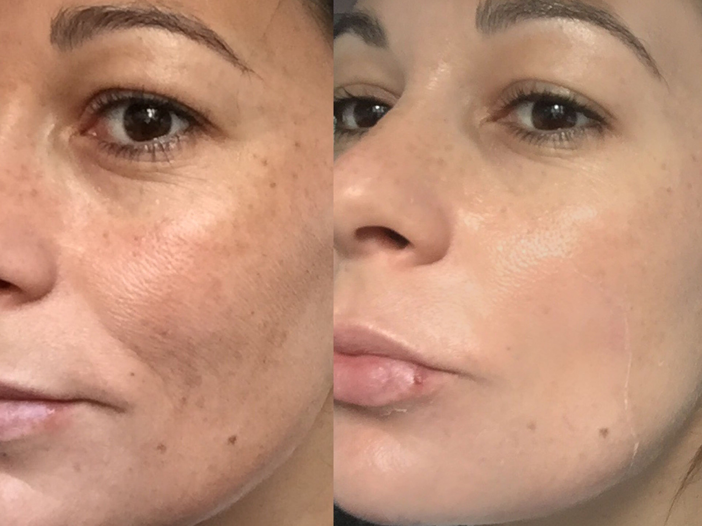 Aclara, despigmenta y regenera tu piel con ✨Luminia – Amélie Colombia